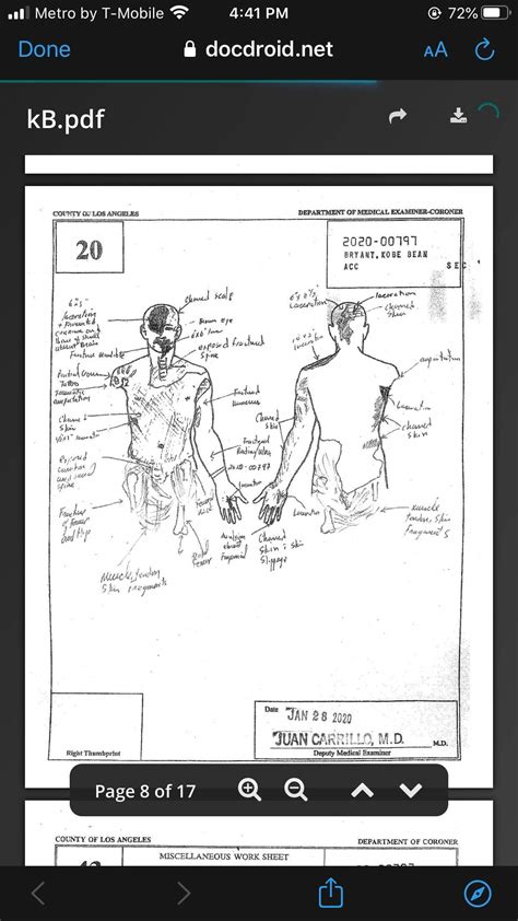 gigis autopsy report|Kobe Crash Autopsy Reports : r/CrimeScene